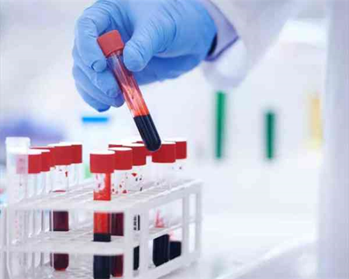 问答：单身做试管50天，孕囊看男女准吗？