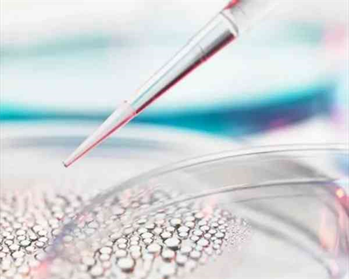 染色体核型分析报告单怎么看 教你看懂染色体报告