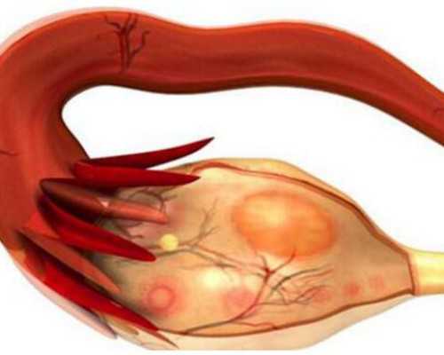 重庆排卵期小肚子胀痛咋回事医院