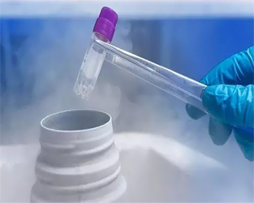 霉菌性阴道炎：因及预防策略大揭秘