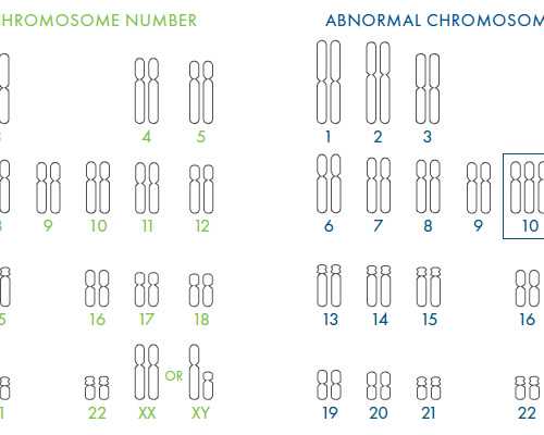子宫肌瘤：这些症状你了解吗？
